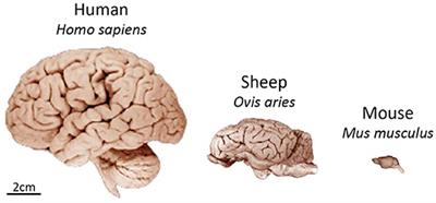 The Translational Benefits of Sheep as Large Animal Models of Human Neurological Disorders